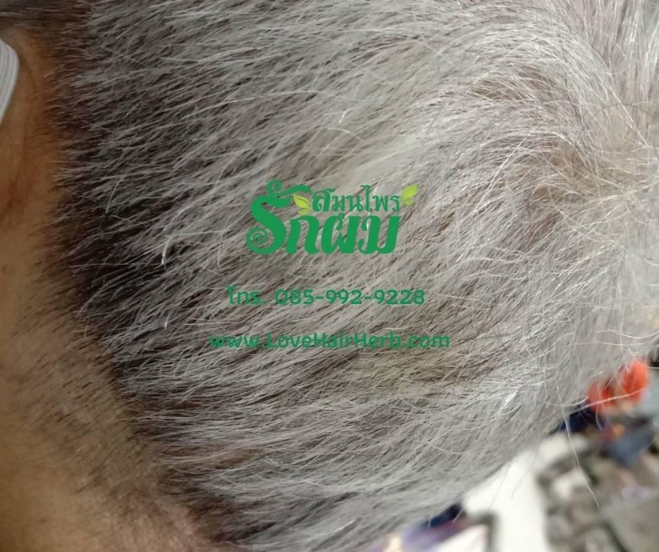 แชมพูสมุนไพรรักผม 250ml x 12 ขวด ยาสระผมแก้รังแคเชื้อรา แก้ผมร่วง แก้ปัญหาผมมัน ผมคัน ชะลอผมหงอก ช่วยให้ผมเกิดใหม่ ไม่ต้องใช้ครีมนวดผม อุดมด้วยสมุนไพรธรรมชาติถึง 9 ชนิด ใช้ได้ทุกวัย สระได้ทุกวัน ปราศจากสารเคมีที่เป็นอันตราย