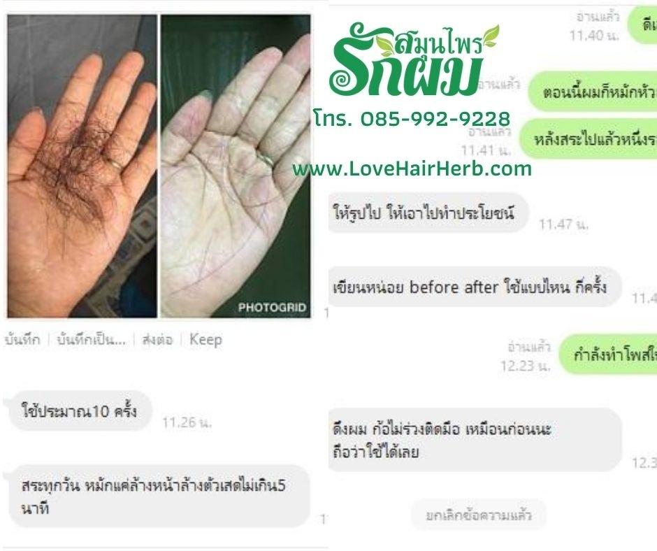 แชมพูสมุนไพรรักผม 250ml x 12 ขวด ยาสระผมแก้รังแคเชื้อรา แก้ผมร่วง แก้ปัญหาผมมัน ผมคัน ชะลอผมหงอก ช่วยให้ผมเกิดใหม่ ไม่ต้องใช้ครีมนวดผม อุดมด้วยสมุนไพรธรรมชาติถึง 9 ชนิด ใช้ได้ทุกวัย สระได้ทุกวัน ปราศจากสารเคมีที่เป็นอันตราย