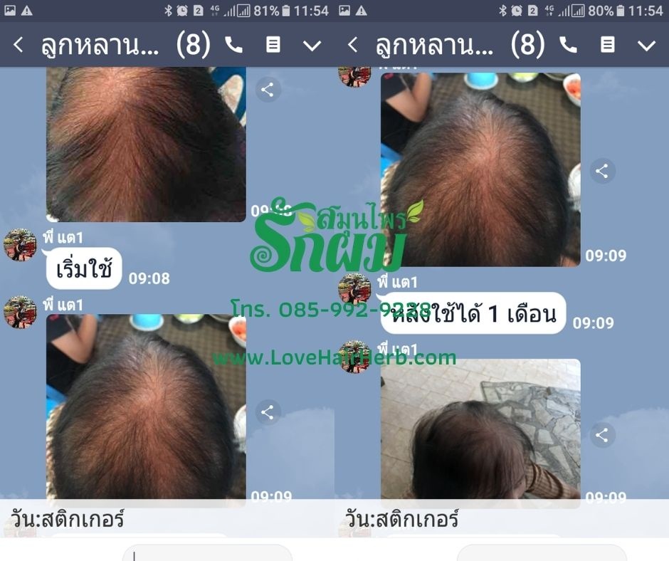 แชมพูสมุนไพรรักผม 250ml x 3 ขวด ยาสระผมแก้รังแคเชื้อรา แก้ผมร่วง แก้ปัญหาผมมัน ผมคัน ชะลอผมหงอก ช่วยให้ผมเกิดใหม่ ไม่ต้องใช้ครีมนวดผม อุดมด้วยสมุนไพรธรรมชาติถึง 9 ชนิด ใช้ได้ทุกวัย สระได้ทุกวัน ปราศจากสารเคมีที่เป็นอันตราย