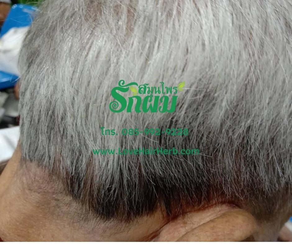 แชมพูสมุนไพรรักผม 250ml x 3 ขวด ยาสระผมแก้รังแคเชื้อรา แก้ผมร่วง แก้ปัญหาผมมัน ผมคัน ชะลอผมหงอก ช่วยให้ผมเกิดใหม่ ไม่ต้องใช้ครีมนวดผม อุดมด้วยสมุนไพรธรรมชาติถึง 9 ชนิด ใช้ได้ทุกวัย สระได้ทุกวัน ปราศจากสารเคมีที่เป็นอันตราย