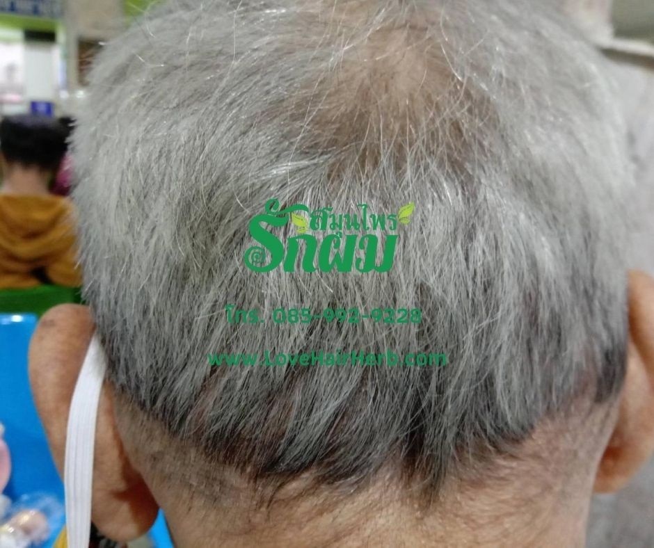 แชมพูสมุนไพรรักผม 250ml x 12 ขวด ยาสระผมแก้รังแคเชื้อรา แก้ผมร่วง แก้ปัญหาผมมัน ผมคัน ชะลอผมหงอก ช่วยให้ผมเกิดใหม่ ไม่ต้องใช้ครีมนวดผม อุดมด้วยสมุนไพรธรรมชาติถึง 9 ชนิด ใช้ได้ทุกวัย สระได้ทุกวัน ปราศจากสารเคมีที่เป็นอันตราย