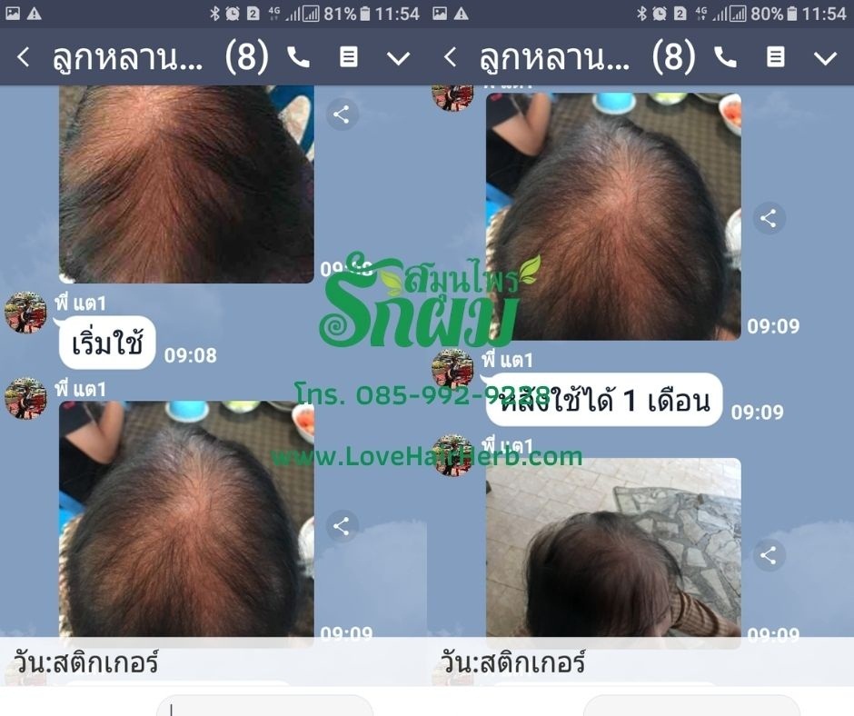 แชมพูสมุนไพรรักผม 250ml x 12 ขวด ยาสระผมแก้รังแคเชื้อรา แก้ผมร่วง แก้ปัญหาผมมัน ผมคัน ชะลอผมหงอก ช่วยให้ผมเกิดใหม่ ไม่ต้องใช้ครีมนวดผม อุดมด้วยสมุนไพรธรรมชาติถึง 9 ชนิด ใช้ได้ทุกวัย สระได้ทุกวัน ปราศจากสารเคมีที่เป็นอันตราย