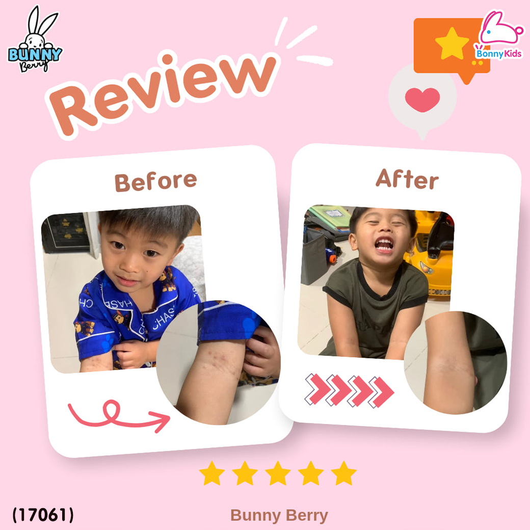 (17061) Bunny Berry (บันนี่ เบอร์รี่) บาลม์สมุนไพร กลิ่นเบอรี่ บรรเทาวัดคัดจมูก น้ำมูกไหล ภูมิแพ้ (สำหรับเด็ก 3 ขวบ ขึ้นไป)