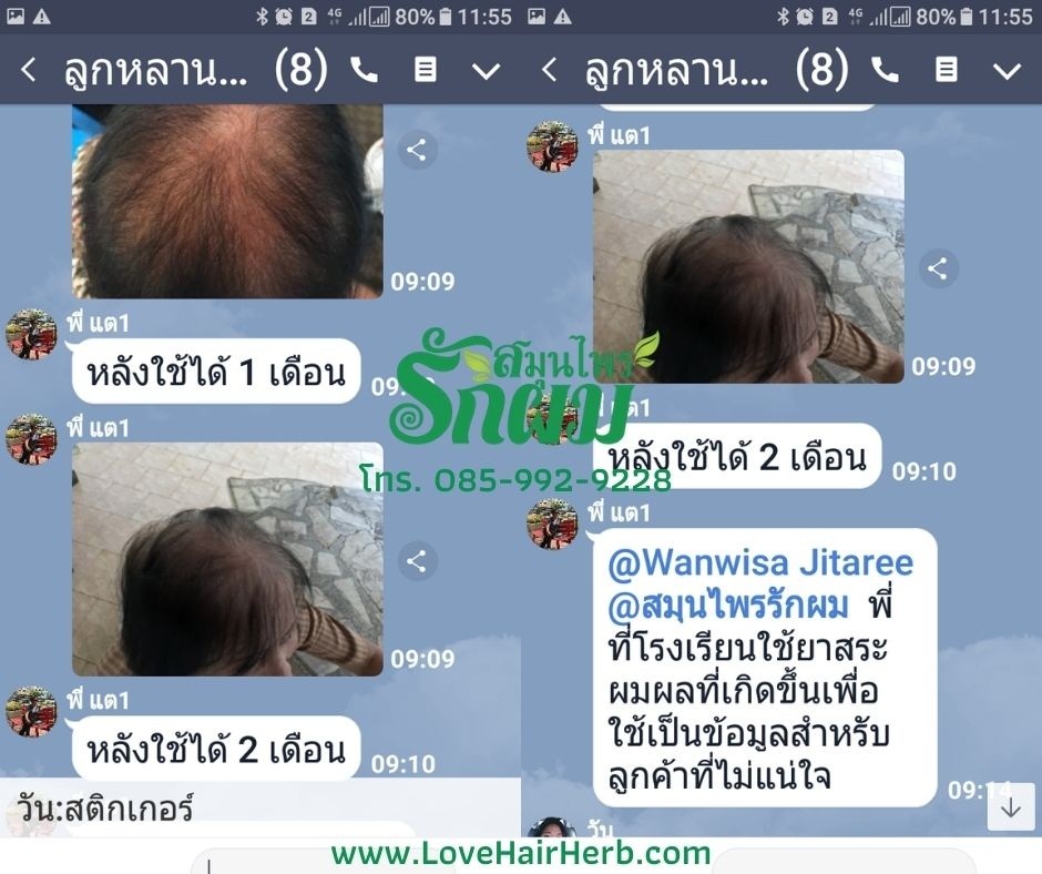 แชมพูสมุนไพรรักผม 250ml x 12 ขวด ยาสระผมแก้รังแคเชื้อรา แก้ผมร่วง แก้ปัญหาผมมัน ผมคัน ชะลอผมหงอก ช่วยให้ผมเกิดใหม่ ไม่ต้องใช้ครีมนวดผม อุดมด้วยสมุนไพรธรรมชาติถึง 9 ชนิด ใช้ได้ทุกวัย สระได้ทุกวัน ปราศจากสารเคมีที่เป็นอันตราย