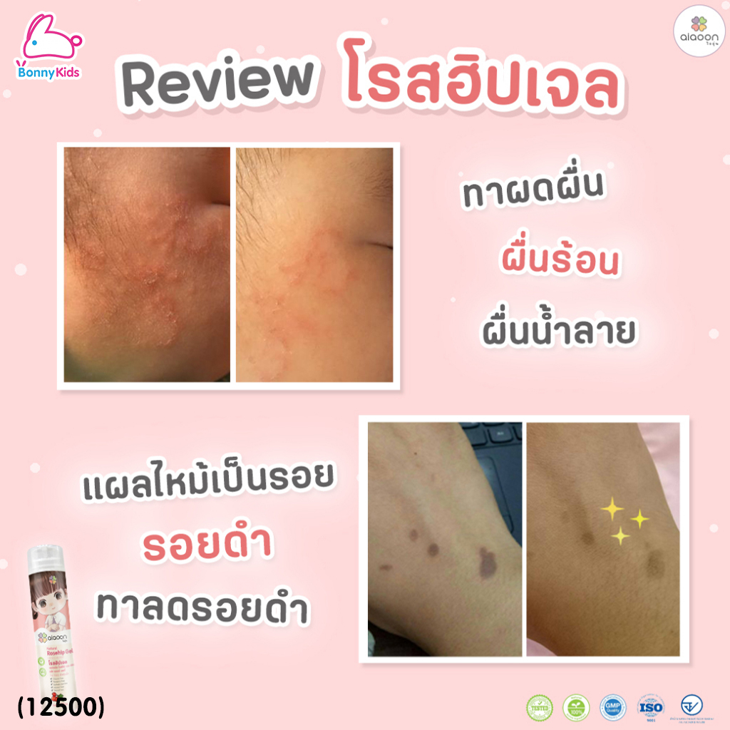 (12500) aiaoon (ไออุ่น) Natural Rosehip Gel for Face and Body โรสฮิปเจล บำรุงผิว "ลดรอยดำ"