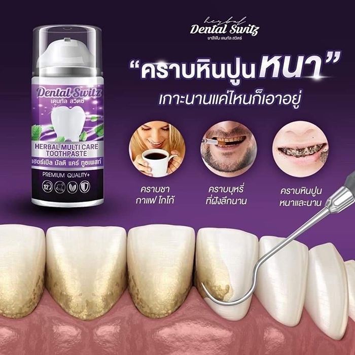 เดนทัลสวิตซ์ Dental Switz