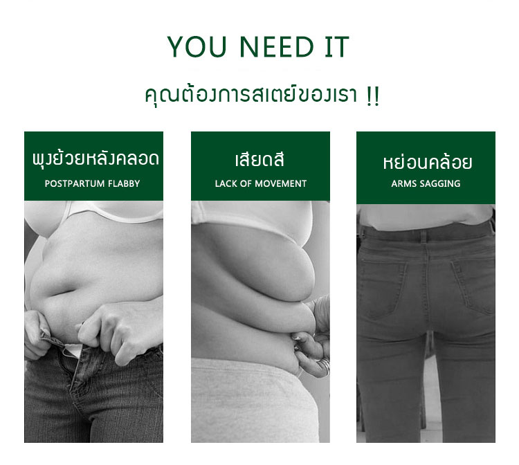 NanaBaby กางเกงในสเตย์ ญ กางเกงในเก็บพุง กระชับหน้าท้องหลังคลอด เนื้อนุ่ม โอบกระชับ สีดำ/สีเนื้อ