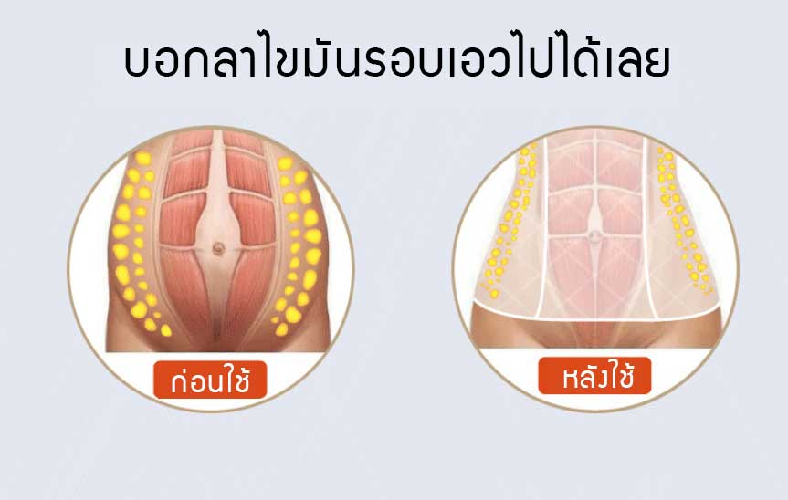 ที่รัดเอวลดพุง สเตย์แผ่น สเตย์กระชับหน้าท้องหลังคลอด เคลื่อนไหวสะดวก ระบายอากาศดี