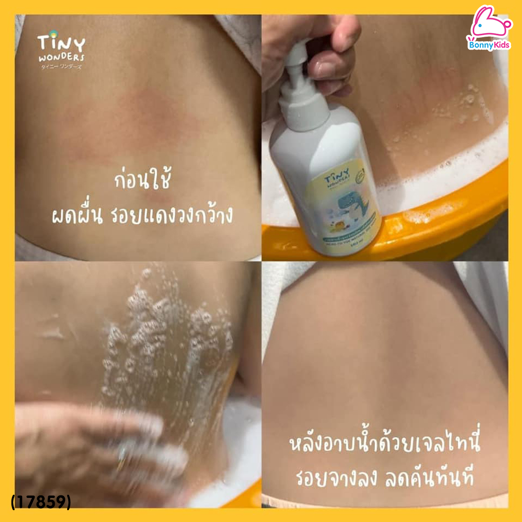 (17859) Tiny Wonders (ไทนี่วันเดอรส์) Head to Toe Natural gel Wash เจลอาบน้ำเด็กสูตรอ่อนโยน ลดคัน ผดผื่น รอยยุง ผิวขาวใส (250ml.)