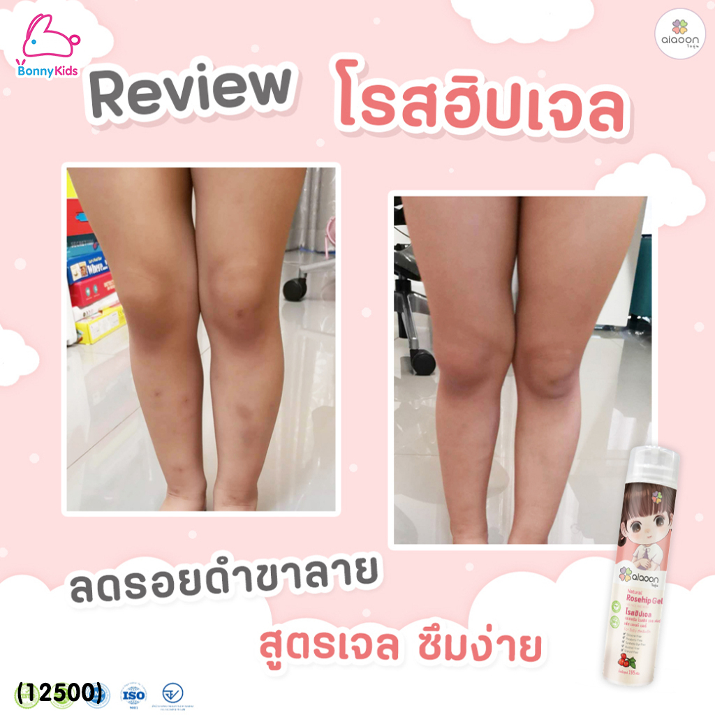 (12500) aiaoon (ไออุ่น) Natural Rosehip Gel for Face and Body โรสฮิปเจล บำรุงผิว "ลดรอยดำ"